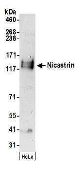 NCSTN / Nicastrin Antibody - Detection of human Nicastrin by western blot. Samples: Whole cell lysate (50 µg) from HeLa cells prepared using RIPA lysis buffer. Antibodies: Affinity purified rabbit anti-Nicastrin antibody used for WB at 1 µg/ml. Detection: Chemiluminescence with an exposure time of 3 minutes.