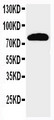 NCSTN / Nicastrin Antibody - WB of NCSTN / Nicastrin antibody. All lanes: Anti-NCSTN at 0.5ug/ml. Lane 1: Rat Brain Tissue Lysate at 40ug. Predicted bind size: 78KD. Observed bind size: 78KD.
