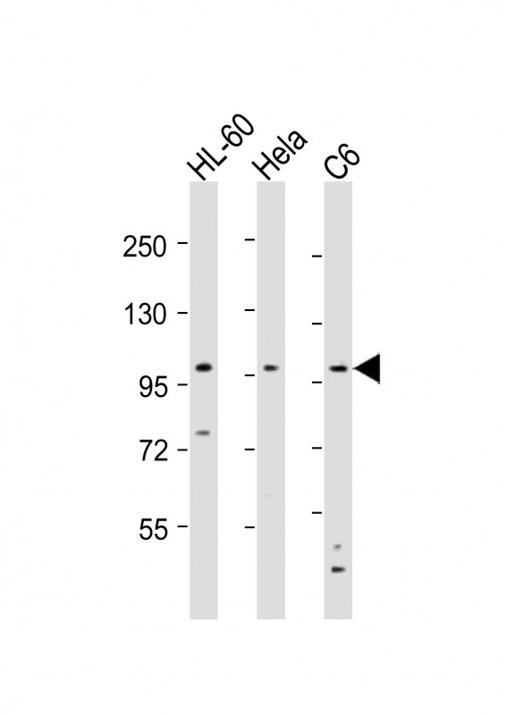 NCSTN / Nicastrin Antibody - All lanes: Anti-NCSTN Antibody (N-Term) at 1:8000 dilution. Lane 1: HL-60 whole cell lysates. Lane 2: HeLa whole cell lysates. Lane 3: C6 whole cell lysates Lysates/proteins at 20 ug per lane. Secondary Goat Anti-Rabbit IgG, (H+L), Peroxidase conjugated at 1:10000 dilution. Predicted band size: 78 kDa. Blocking/Dilution buffer: 5% NFDM/TBST.