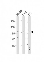 NCSTN / Nicastrin Antibody - All lanes: Anti-NCSTN Antibody (N-Term) at 1:8000 dilution. Lane 1: HL-60 whole cell lysates. Lane 2: HeLa whole cell lysates. Lane 3: C6 whole cell lysates Lysates/proteins at 20 ug per lane. Secondary Goat Anti-Rabbit IgG, (H+L), Peroxidase conjugated at 1:10000 dilution. Predicted band size: 78 kDa. Blocking/Dilution buffer: 5% NFDM/TBST.