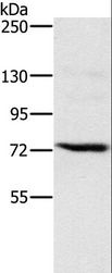 NCSTN / Nicastrin Antibody - Western blot analysis of Jurkat cell, using NCSTN Polyclonal Antibody at dilution of 1:500.