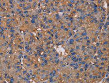 NCSTN / Nicastrin Antibody - Immunohistochemistry of paraffin-embedded Human brain using NCSTN Polyclonal Antibody at dilution of 1:50.