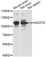 NCSTN / Nicastrin Antibody - Western blot analysis of extracts of various cell lines, using NCSTN antibody at 1:1000 dilution. The secondary antibody used was an HRP Goat Anti-Rabbit IgG (H+L) at 1:10000 dilution. Lysates were loaded 25ug per lane and 3% nonfat dry milk in TBST was used for blocking. An ECL Kit was used for detection and the exposure time was 10s.