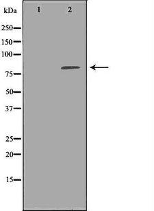 NCSTN / Nicastrin Antibody - Western blot analysis of brain tissue using NCSTN antibody. The lane on the left is treated with the antigen-specific peptide.