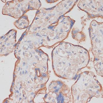NCSTN / Nicastrin Antibody - Immunohistochemistry of paraffin-embedded Human placenta using NCSTN Polyclonal Antibody at dilution of 1:100 (40x lens).