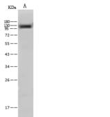 NCSTN / Nicastrin Antibody - Anti-NCSTN rabbit polyclonal antibody at 1:500 dilution. Lane A: Mouse brain tissue lysate. Lysates/proteins at 30 ug per lane. Secondary: Goat Anti-Rabbit IgG (H+L)/HRP at 1/10000 dilution. Developed using the ECL technique. Performed under reducing conditions. Predicted band size: 78 kDa. Observed band size: 130 kDa.