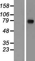 NCSTN / Nicastrin Protein - Western validation with an anti-DDK antibody * L: Control HEK293 lysate R: Over-expression lysate