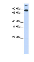 NDC1 / TMEM48 Antibody - TMEM48 antibody Western blot of Fetal Lung lysate. This image was taken for the unconjugated form of this product. Other forms have not been tested.