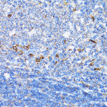 NDE1 Antibody - Immunohistochemistry of paraffin-embedded rat spleen tissue.
