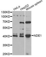 NDE1 Antibody - Western blot analysis of extracts of various cell lines, using NDE1 antibody at 1:1000 dilution. The secondary antibody used was an HRP Goat Anti-Rabbit IgG (H+L) at 1:10000 dilution. Lysates were loaded 25ug per lane and 3% nonfat dry milk in TBST was used for blocking.