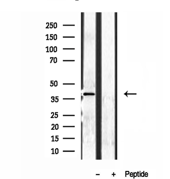 NDE1 Antibody - Western blot analysis of extracts of A2780 cells using NDE1 antibody.