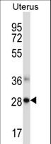 NDFIP1 / N4WBP5 Antibody - NDFIP1 Antibody western blot of human normal Uterus tissue lysates (35 ug/lane). The NDFIP1 antibody detected the NDFIP1 protein (arrow).