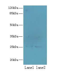 NDFIP1 / N4WBP5 Antibody - Western blot. All lanes: NDFIP1 antibody at 8 ug/ml. Lane 1: 293T whole cell lysate. Lane 2: HeLa whole cell lysate. Secondary Goat polyclonal to Rabbit IgG at 1:10000 dilution. Predicted band size: 25 kDa. Observed band size: 25 kDa.