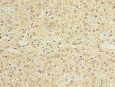 NDFIP1 / N4WBP5 Antibody - Immunohistochemistry of paraffin-embedded human adrenal gland tissue using antibody at dilution of 1:100.