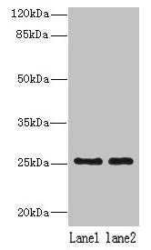NDFIP1 / N4WBP5 Antibody - Western blot All lanes: NDFIP1 antibody at 8µg/ml Lane 1: 293T whole cell lysate Lane 2: Hela whole cell lysate Secondary Goat polyclonal to rabbit IgG at 1/10000 dilution Predicted band size: 25, 17 kDa Observed band size: 25 kDa