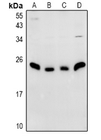 NDFIP1 / N4WBP5 Antibody - Western blot analysis of N4WBP5 expression in C6 (A), AML12 (B), HepG2 (C), HEK293T (D) whole cell lysates.