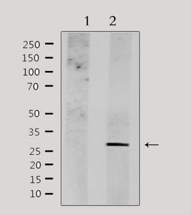 NDFIP1 / N4WBP5 Antibody - Western blot analysis of extracts of HepG2 cells using NDFIP1 antibody. Lane 1 was treated with the antigen-specific peptide.