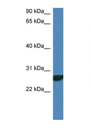 NDFIP2 Antibody - NDFIP2 antibody Western blot of Rat Lung lysate. Antibody concentration 1 ug/ml. This image was taken for the unconjugated form of this product. Other forms have not been tested.