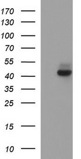 NDN / Necdin Antibody - HEK293T cells were transfected with the pCMV6-ENTRY control (Left lane) or pCMV6-ENTRY NDN (Right lane) cDNA for 48 hrs and lysed. Equivalent amounts of cell lysates (5 ug per lane) were separated by SDS-PAGE and immunoblotted with anti-NDN.