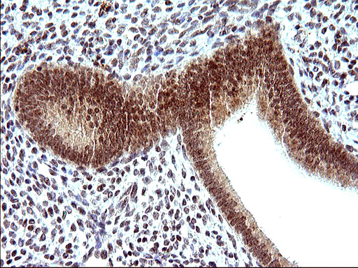 NDN / Necdin Antibody - IHC of paraffin-embedded Human endometrium tissue using anti-NDN mouse monoclonal antibody. (Heat-induced epitope retrieval by 10mM citric buffer, pH6.0, 120°C for 3min).
