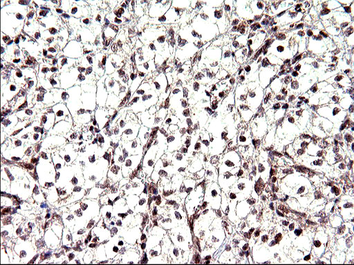 NDN / Necdin Antibody - IHC of paraffin-embedded Human bladder tissue using anti-NDN mouse monoclonal antibody. (Heat-induced epitope retrieval by 10mM citric buffer, pH6.0, 120°C for 3min).