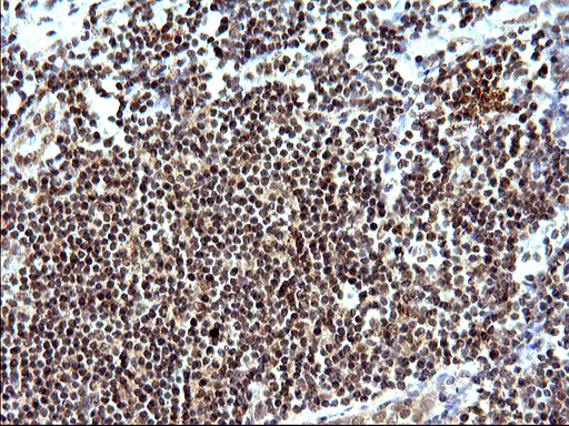 NDN / Necdin Antibody - IHC of paraffin-embedded Human lymph node tissue using anti-NDN mouse monoclonal antibody. (Heat-induced epitope retrieval by 10mM citric buffer, pH6.0, 120°C for 3min).