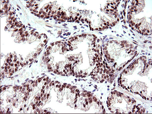 NDN / Necdin Antibody - IHC of paraffin-embedded Human prostate tissue using anti-NDN mouse monoclonal antibody. (Heat-induced epitope retrieval by 10mM citric buffer, pH6.0, 120°C for 3min).