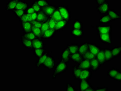 NDN / Necdin Antibody - Immunofluorescence staining of Hela cells at a dilution of 1:133, counter-stained with DAPI. The cells were fixed in 4% formaldehyde, permeabilized using 0.2% Triton X-100 and blocked in 10% normal Goat Serum. The cells were then incubated with the antibody overnight at 4 °C.The secondary antibody was Alexa Fluor 488-congugated AffiniPure Goat Anti-Rabbit IgG (H+L) .