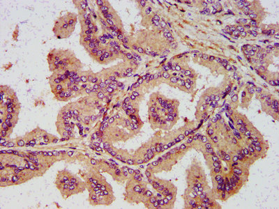 NDN / Necdin Antibody - Immunohistochemistry image at a dilution of 1:400 and staining in paraffin-embedded human prostate tissue performed on a Leica BondTM system. After dewaxing and hydration, antigen retrieval was mediated by high pressure in a citrate buffer (pH 6.0) . Section was blocked with 10% normal goat serum 30min at RT. Then primary antibody (1% BSA) was incubated at 4 °C overnight. The primary is detected by a biotinylated secondary antibody and visualized using an HRP conjugated SP system.