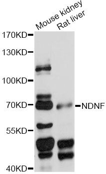 NDNF Antibody - Western blot analysis of extracts of various cell lines, using NDNF antibody at 1:1000 dilution. The secondary antibody used was an HRP Goat Anti-Rabbit IgG (H+L) at 1:10000 dilution. Lysates were loaded 25ug per lane and 3% nonfat dry milk in TBST was used for blocking. An ECL Kit was used for detection and the exposure time was 30s.