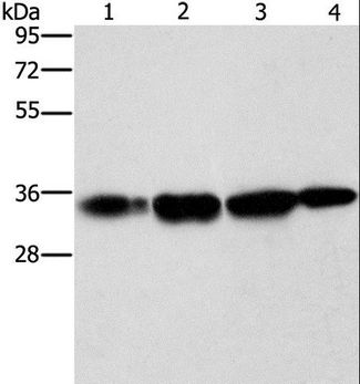 NDNL2 Antibody - Western blot analysis of HeLa cell and human prostate tissue, A172 cell and mouse liver tissue, using NDNL2 Polyclonal Antibody at dilution of 1:1500.