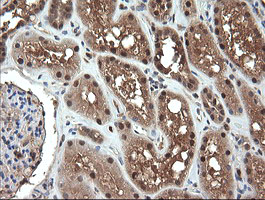 NDOR1 Antibody - IHC of paraffin-embedded Human Kidney tissue using anti-NDOR1 mouse monoclonal antibody. (Heat-induced epitope retrieval by 10mM citric buffer, pH6.0, 120°C for 3min).