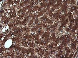 NDOR1 Antibody - IHC of paraffin-embedded Human liver tissue using anti-NDOR1 mouse monoclonal antibody. (Heat-induced epitope retrieval by 10mM citric buffer, pH6.0, 120°C for 3min).
