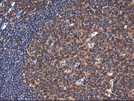 NDOR1 Antibody - IHC of paraffin-embedded Human tonsil using anti-NDOR1 mouse monoclonal antibody. (Heat-induced epitope retrieval by 10mM citric buffer, pH6.0, 120°C for 3min).