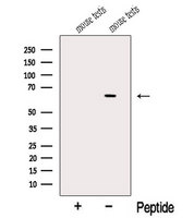 NDOR1 Antibody - Western blot analysis of extracts of mouse testis tissue using NDOR1 antibody. The lane on the left was treated with blocking peptide.