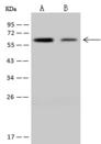 NDOR1 Antibody - Anti-NDOR1 rabbit polyclonal antibody at 1:500 dilution. Lane A: Jurka Whole Cell Lysate. Lane B: NIH-3T3 Whole Cell Lysate. Lysates/proteins at 30 ug per lane. Secondary: Goat Anti-Rabbit IgG (H+L)/HRP at 1/10000 dilution. Developed using the ECL technique. Performed under reducing conditions. Predicted band size: 67 kDa. Observed band size: 67 kDa.
