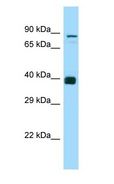 NDOR1 Antibody - NDOR1 antibody Western Blot of ACHN.  This image was taken for the unconjugated form of this product. Other forms have not been tested.