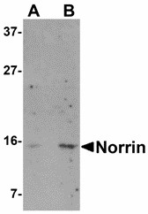 NDP Antibody - Western blot of Norrin in Jurkat cell lysate with Norrin antibody at (A) 1 and (B) 2 ug/ml. Below: Immunocytochemistry of Norrin in Jurkat cells with Norrin antibody at 5 ug/ml.