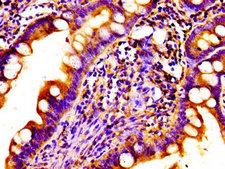 NDP Antibody - Immunohistochemistry image of paraffin-embedded human small intestine tissue at a dilution of 1:100