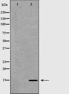 NDP Antibody - Western blot analysis of mouse liver tissue lysates using NDP antibody. The lane on the left is treated with the antigen-specific peptide.