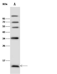 NDP Antibody - Anti-NDP rabbit polyclonal antibody at 1:500 dilution. Lane A: Jurkat Whole Cell Lysate. Lysates/proteins at 30 ug per lane. Secondary: Goat Anti-Rabbit IgG (H+L)/HRP at 1/10000 dilution. Developed using the ECL technique. Performed under reducing conditions. Predicted band size: 15 kDa. Observed band size: 15 kDa. (We are unsure as to the identity of these extra bands.)