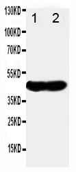 NDRG1 Antibody - WB of NDRG1 antibody. All lanes: Anti-NDRG1 at 0.5ug/ml. Lane 1: SMMC Nucleus Cell Lysate at 40ug. Lane 2: SMMC Cytoplasm Cell Lysate at 40ug. Predicted bind size: 43KD. Observed bind size: 43KD.