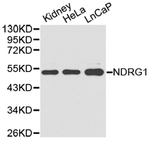 NDRG1 Antibody - Western blot of extracts of various cell lines, using NDRG1 antibody.