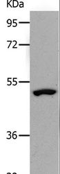 NDRG1 Antibody - Western blot analysis of Human lymphoma tissue, using NDRG1 Polyclonal Antibody at dilution of 1:1000.