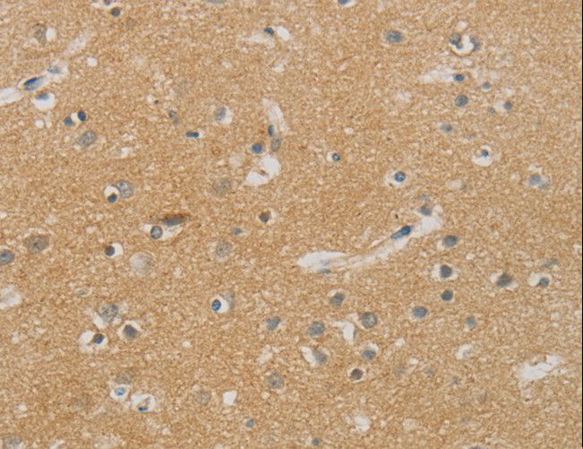 NDRG1 Antibody - Immunohistochemistry of paraffin-embedded Human brain using NDRG1 Polyclonal Antibody at dilution of 1:70.