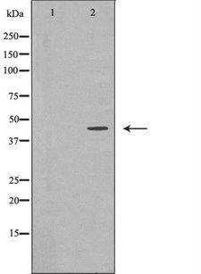 NDRG1 Antibody - Western blot analysis of HeLa whole cells lysates using NDRG1 antibody. The lane on the left is treated with the antigen-specific peptide.