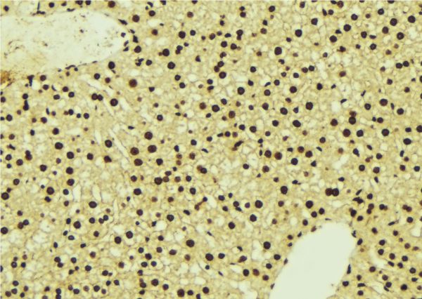 NDRG1 Antibody - 1:100 staining mouse liver tissue by IHC-P. The sample was formaldehyde fixed and a heat mediated antigen retrieval step in citrate buffer was performed. The sample was then blocked and incubated with the antibody for 1.5 hours at 22°C. An HRP conjugated goat anti-rabbit antibody was used as the secondary.