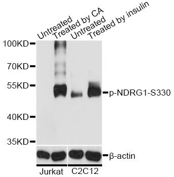 NDRG1 Antibody - Western blot analysis of extracts of Jurkat and C2C12 cells, using Phospho-NDRG1-S330 antibody at 1:2000 dilution. Jurkat cells were treated by Calyculin A (100nM) for 30 minutes.C2C12 cells were treated by Insulin (100nM) for 30 minutes after serum-starvation overnight. The secondary antibody used was an HRP Goat Anti-Rabbit IgG (H+L) at 1:10000 dilution. Lysates were loaded 25ug per lane and 3% nonfat dry milk in TBST was used for blocking. Blocking buffer: 3% BSA.An ECL Kit was used for detection and the exposure time was 1s.