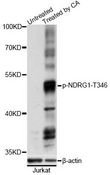 NDRG1 Antibody - Western blot analysis of extracts of Jurkat cells, using Phospho-NDRG1-T346 antibody at 1:2000 dilution. Jurkat cells were treated by Calyculin A (100nM) for 30 minutes. The secondary antibody used was an HRP Goat Anti-Rabbit IgG (H+L) at 1:10000 dilution. Lysates were loaded 25ug per lane and 3% nonfat dry milk in TBST was used for blocking. Blocking buffer: 3% BSA.An ECL Kit was used for detection and the exposure time was 1s.