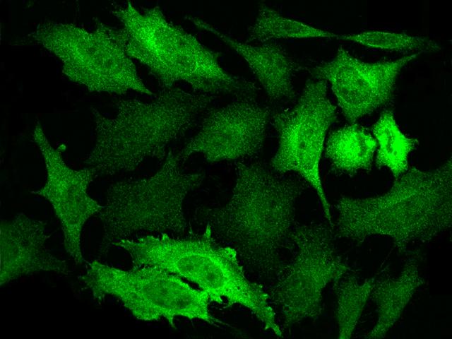 NDRG1 Antibody - Immunofluorescence staining of NDRG1-His in HeLa cells. Cells were fixed with 4% PFA, permeabilzed with 0.3% Triton X-100 in PBS, blocked with 10% serum, and incubated with rabbit anti-Human NDRG1-His polyclonal antibody (dilution ratio 1:1000) at 4°C overnight. Then cells were stained with the Alexa Fluor 488-conjugated Goat Anti-rabbit IgG secondary antibody (green). Positive staining was localized to cytoplasm and nucleus.
